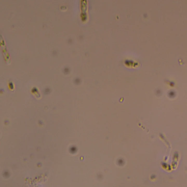 Phase-contrast micrograph with rod-shaped bacteria of several sizes