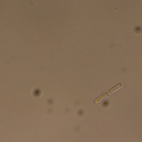 Phase-contrast view of Flavobacterium johnsoniae