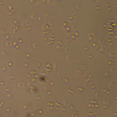 Phase-contrast view of Klebsiella aerogenes